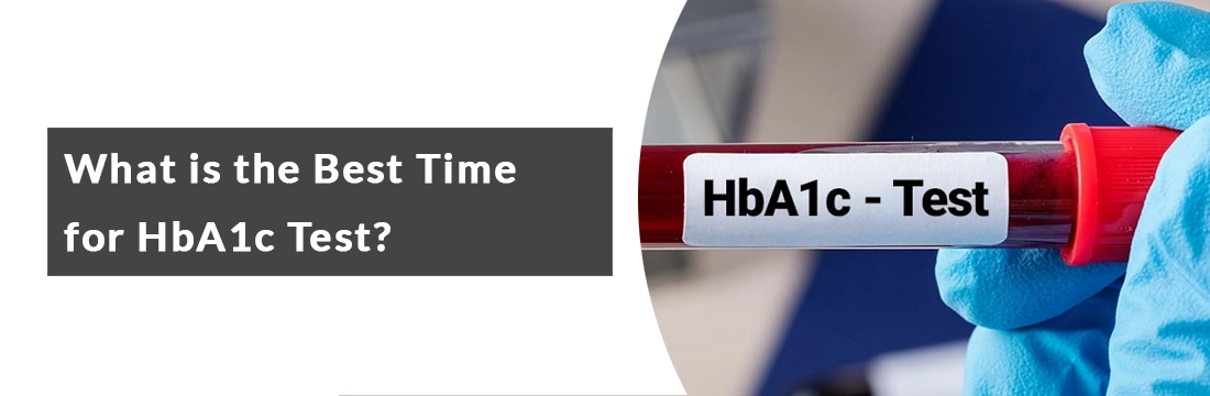 What is the Best Time for HbA1c Test? When to Measure Hemoglobin A1c Levels